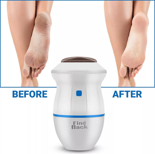 Rechargeable/electric foot pedicure grinder